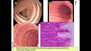 OSPE in Anatomy of Gastrointestinal and Renal Systems [upl. by Holna903]