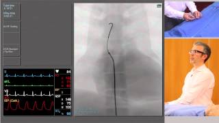 Catheterisation Left and Right Coronary Arteries [upl. by Iila]