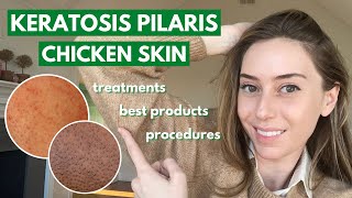 Keratosis Pilaris How to treat dry bumpy skin aka chicken skin  Dr Shereene Idriss [upl. by Hofmann581]