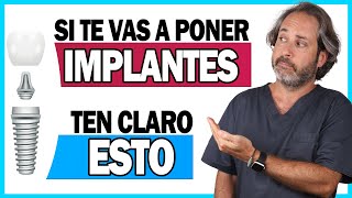 📌𝗜𝗡𝗙𝗢𝗥𝗠𝗔𝗖𝗜𝗢𝗡 𝗖𝗟𝗔𝗩𝗘 sobre la 𝗖𝗢𝗟𝗢𝗖𝗔𝗖𝗜𝗢𝗡 𝗜𝗠𝗣𝗟𝗔𝗡𝗧𝗘𝗦 dentales paso a paso explicada TE INTERESA 👌 [upl. by Corley]