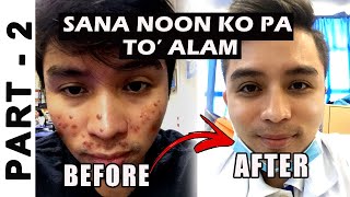 How to Treat Acne and Pimples on Face  How to Get Rid of Acne  Prevent Acne and Pimple  PART 2 [upl. by Tnahsin]