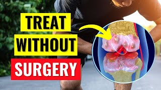 The Best Knee Arthritis Treatments Without Surgery [upl. by Nitsoj]