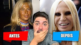 PLÁSTICAS DOS FAMOSOS QUE DERAM ERRADO [upl. by Adnohryt]