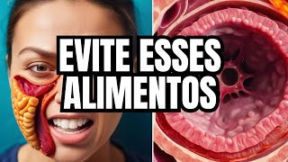 ❌ PARE de comer isso na SÍNDROME DO INTESTINO IRRITÁVEL [upl. by Edythe]