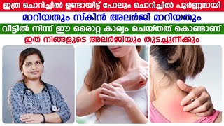 ചൊറിച്ചിൽ മാറാനും സ്കിൻ അലര്ജി മാറാനും വീട്ടിൽ നിന്ന് ഇങ്ങനെ ചെയ്താൽ മതി SKIN ALLERGY maran [upl. by Chandos]