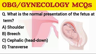 OBG GYNECOLOGY MCQs rrbnursingofficerexam aiimsnorcetmcq [upl. by Ecirted]