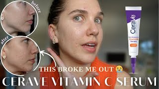 CeraVe Skin Renewing Vitamin C Serum 30 Day Review  AcneProne  Sensitive Skin [upl. by Anirehtak]