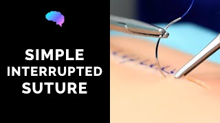 Simple interrupted suture wound suturing  OSCE Guide  UKMLA  CPSA [upl. by Irvin]