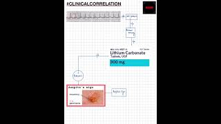 Shorts ClinicalCorrelation NEETNEXTPGFMGEMBBSWPW SYNDROME EBSTEIN ANOMALY LITHIUMPSORIASIS [upl. by Sitof997]