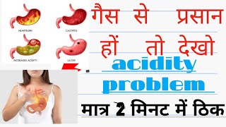 dompan acidity गैस से prasan hai  Dompan tab use how To acidity problem with solusane kya hai [upl. by Asiuqram]