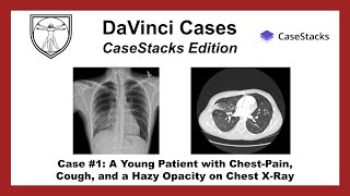 Chest XRay and Chest CT Interpretation [upl. by Airyt]