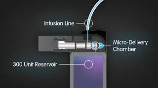 tslim X2 Insulin Pump  MicroDelivery Technology [upl. by Vic]