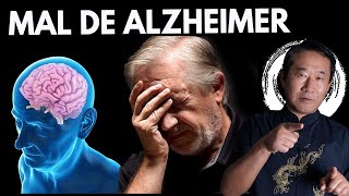 Mal de Alzheimer o que é e como prevenir [upl. by Aguie21]