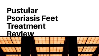 Pustular Psoriasis Feet Treatment Review [upl. by Gaul]