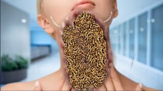 ASMR Cheek Treatment Animation  ASMR Remove Maggots from Gaal [upl. by Gaylord677]