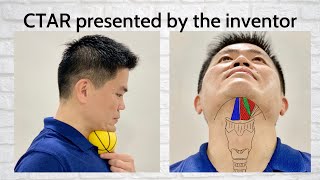 Dysphagia Swallowing Exercise  Chin Tuck Against Resistance with Ball by CTAR Inventor English [upl. by Tremayne]