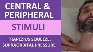 Central and Peripheral Stimuli Trapezius Squeeze Supraorbital Pressure  Nursing Neuro Assessment [upl. by Anoi]