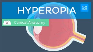 Farsightedness Hyperopia Definition causes symptoms diagnosis and treatment  Kenhub [upl. by Toille]