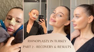 Rhinoplastynose job experience in Turkey vlog pt 2  surgery recovery amp results  Dr Orhan Ucal [upl. by Warrick]