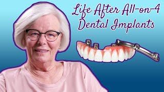 Life After All on 4 Dental Implants  8 Months Post Surgery [upl. by Aicertap853]