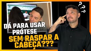 DÁ PARA USAR UMA PRÓTESE SEM RASPAR A CABEÇA [upl. by Yengac874]