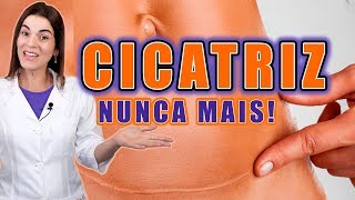 Adeus CICATRIZ no Rosto e no Corpo  Saiba como TRATAR e PREVENIR CICATRIZES [upl. by Supple]