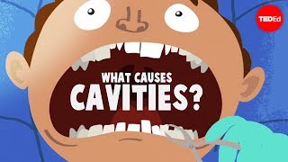 What causes cavities  Mel Rosenberg [upl. by Brandice]