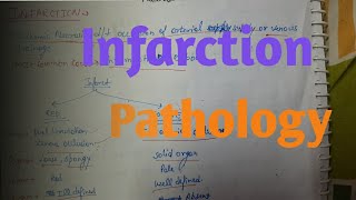 Infarction Pathology [upl. by Mellette145]