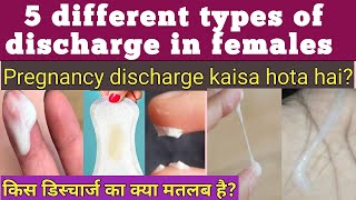 5 types of Discharge in females kis discharg ka kya matlab hota hai pregnancy discharge kaisa hota h [upl. by Marmion]