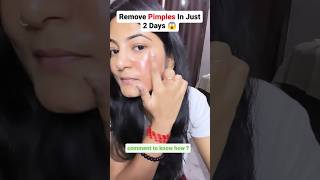 😱 Remove Pimples In Just 2 Days  Secret to remove pimples pimplefree skincareroutine shorts [upl. by Teria]