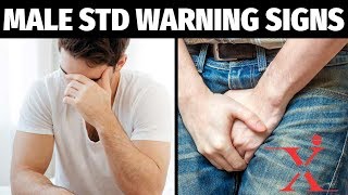 Common STDs Warning Signs amp Symptoms of Viral STDs [upl. by Nosyla]