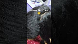 Nits lice treatment 100 result within 2hrs Chennaiheadlicetreatmentliceremovalnitsliceheadlice [upl. by Ninaj286]