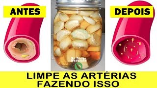 Esta Receita SUGA A GORDURA das Veias Igual Aspirador Suga Poeira [upl. by Adym187]