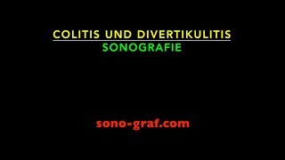 076  Sonografie  Colitis und Divertikulitis [upl. by Mutua264]