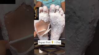 🔥Repair Cracked Heels In 1Day  Get Rid Of Dry Feet  Get Fairamp Soft Feet Instantly✅💯crackedshorts [upl. by Elbertine]