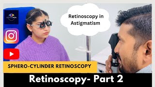 Retinoscopy Part 2  Static Retinoscopy for astigmatism  SpheroCylinder method [upl. by Dorrej]