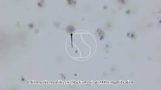 Chilomastix mesnili Cyst under the microscope [upl. by Saqaw]