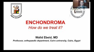 Lecture7  Enchondroma “How do we treat it” 📝🩺 [upl. by Mommy]