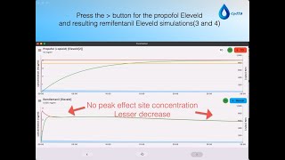 The Paedfusor versus Eleveldopioid used in the Mixifusor A Tivatrainer simulation [upl. by Nyladnek]