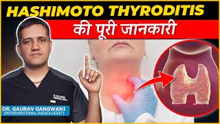 Complete Information About Hashimoto thyroiditis  Dr Gaurav Gangwami Interventional Radiologist [upl. by Sebbie]