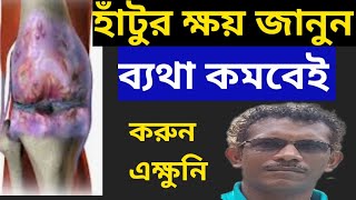 হাঁটুর ক্ষয় রুখতে ও ব্যাথা কমাতে এই কাজটি করুন Prevent Arthritis and knee Pain [upl. by Neil262]