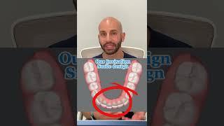 How We Used Invisalign to Fix Lower Front Teeth Overcrowding 2024 [upl. by Edmonda]