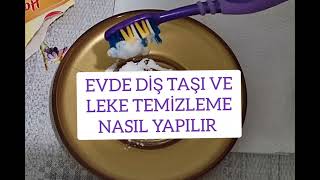 EVDE DİŞ TAŞI DİŞ LEKELERİ VE KARARMALARI NASIL TEMİZLENİR 👍🌺🌺 [upl. by Soulier]