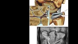 MRI WRIST 2014 DR AMR SAADAWYPART 1 [upl. by Ayotak]