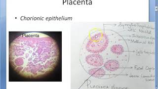 Obstetrics 243 GESTATIONAL TROPHOBLASTIC DISEASES Placental tumor Hydatidiform Mole Choriocarcinoma [upl. by Angelina]