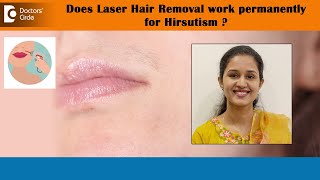 Laser Hair Removal for Hirsutism Excessive hair in FemaleHIRSUTISMDrAbhijna Rai Doctors’ Circle [upl. by Ahsaret218]