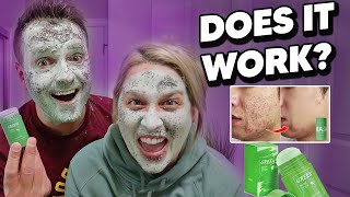 DOES THE GREEN MASK STICK REALLY WORK Unbelievable Results [upl. by Ventura]