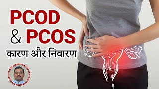 PCOD and PCOS  Symptoms and Treatment  100 Treatment  Rishiraj Ayurvedam [upl. by Loren708]