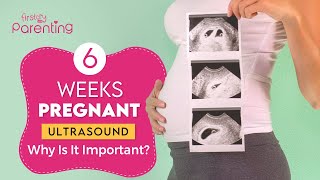 6 Weeks Pregnancy Ultrasound  Why Is It Important amp What to Expect [upl. by Ezana]