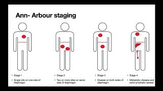 Hodgkin and NonHodgkin lymphoma [upl. by Reeta291]